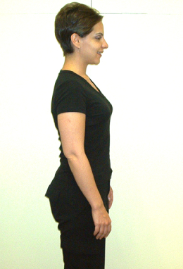 Dr. Dom's Patient Posture after Chiropractic Treatment image 2